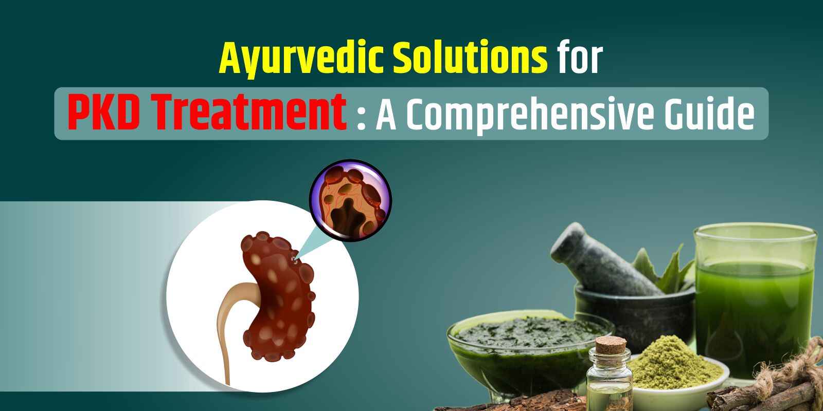 Ayurvedic Solutions for PKD Treatment: A Comprehensive Guide